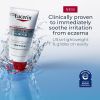 Eucerin Eczema Relief Hydrogel, Fragrance Free, Steroid Free, 5 oz Tube