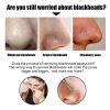 Black Pig Nose Patch  Bamboo Charcoal Blackheads & Acne Removal  Rip-Off Nose Mask Patch
